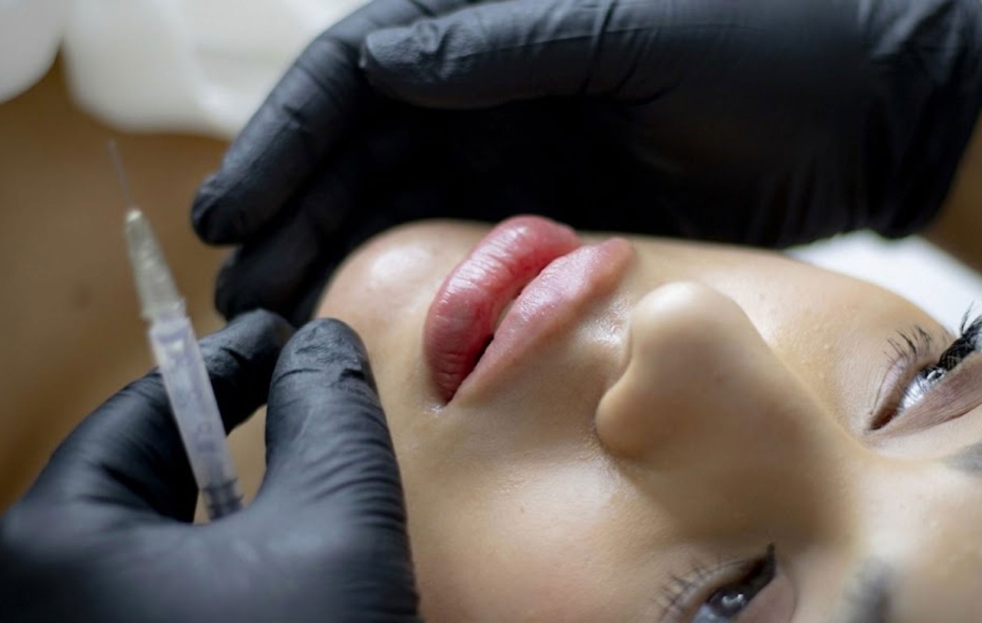 Client during treatment at VIO