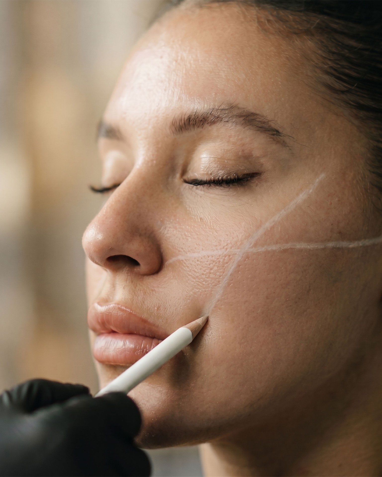 Biostimulators treatment at VIO Med Spa Chesterfield